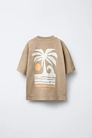 ENSEMBLE TEINT EN PIÈCE T-SHIRT IMPRIMÉ ET BERMUDA