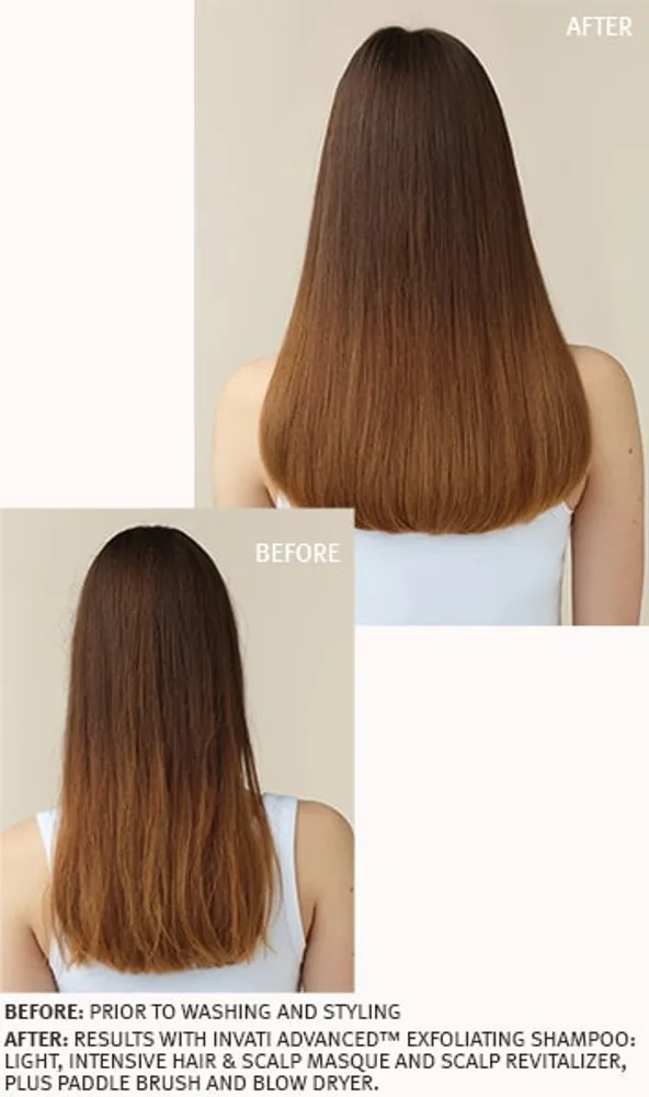 invati advanced™ intensive hair and scalp masque