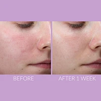 DeliKate™ Recovery Serum