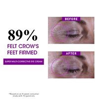 Super Multi-Corrective Anti-Aging Eye Cream