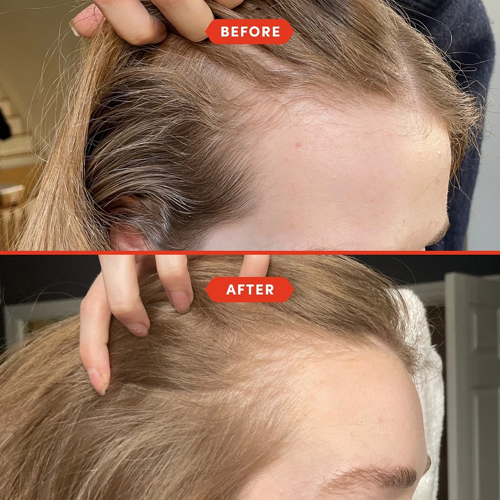 HoliRoots™ Pre-Wash Scalp & Hair Treatment Oil