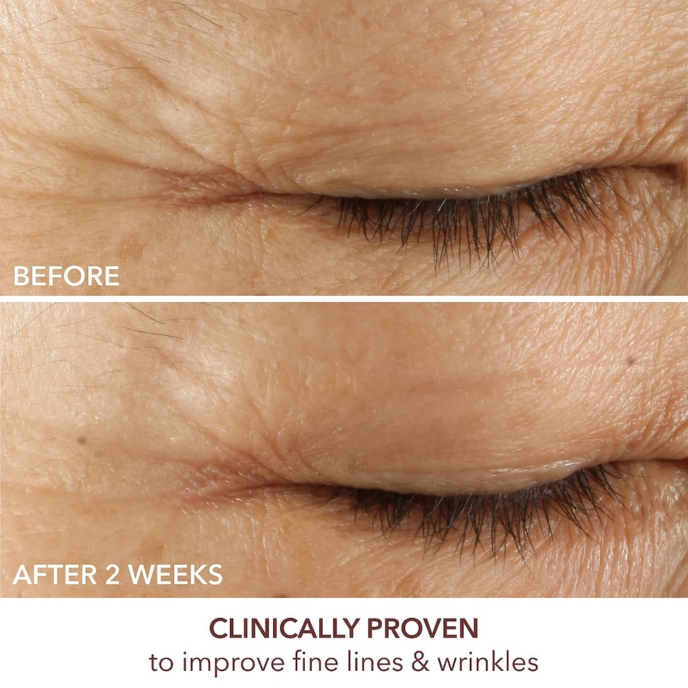 Advanced Retinol + Ferulic Triple Correction Eye Serum