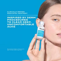 Deep Relief Acne Treatment with Salicylic Acid Liquid Pimple Patch for Painful Acne
