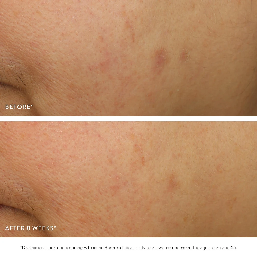 GOOPGLOW Exfoliating Dark Spot Sleep Serum