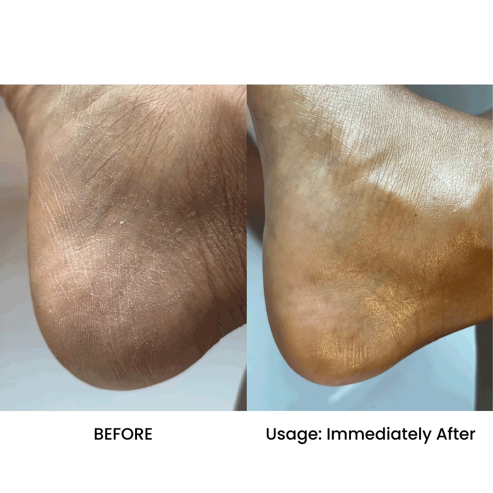 AFRICAN Beauty Butter- Intensive Dry Skin Treatment