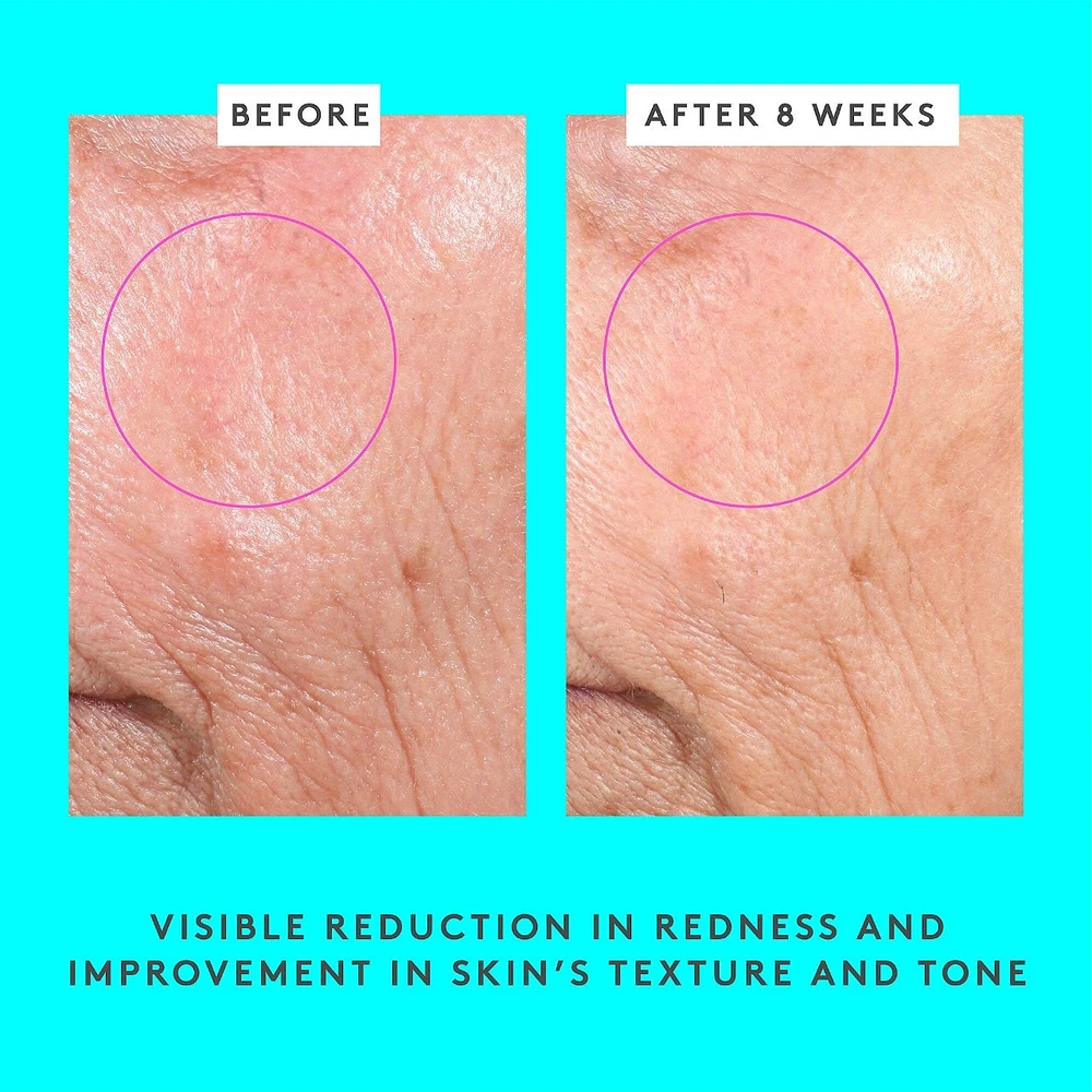Bouncy Brightfacial Brightening Mask with 10% Azelaic Acid + 1% Salicylic Acid
