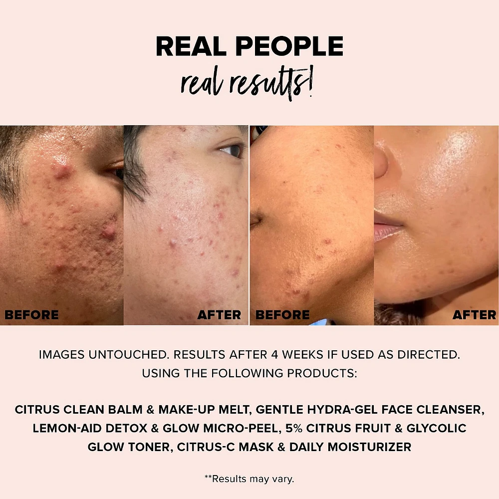 5% Citrus Fruit & Glycolic Glow Toner