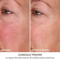 DermInfusions™ Fill + Repair Serum with Hyaluronic Acid