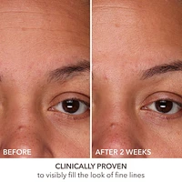 DermInfusions™ Fill + Repair Serum with Hyaluronic Acid