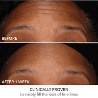 DermInfusions™ Fill + Repair Serum with Hyaluronic Acid