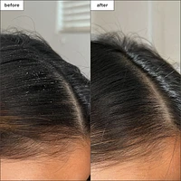 Scalp Revival™ Charcoal + Tea Tree Buildup Detox Spray