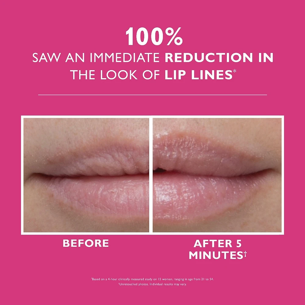 Instant FIRMx® Lip Filler