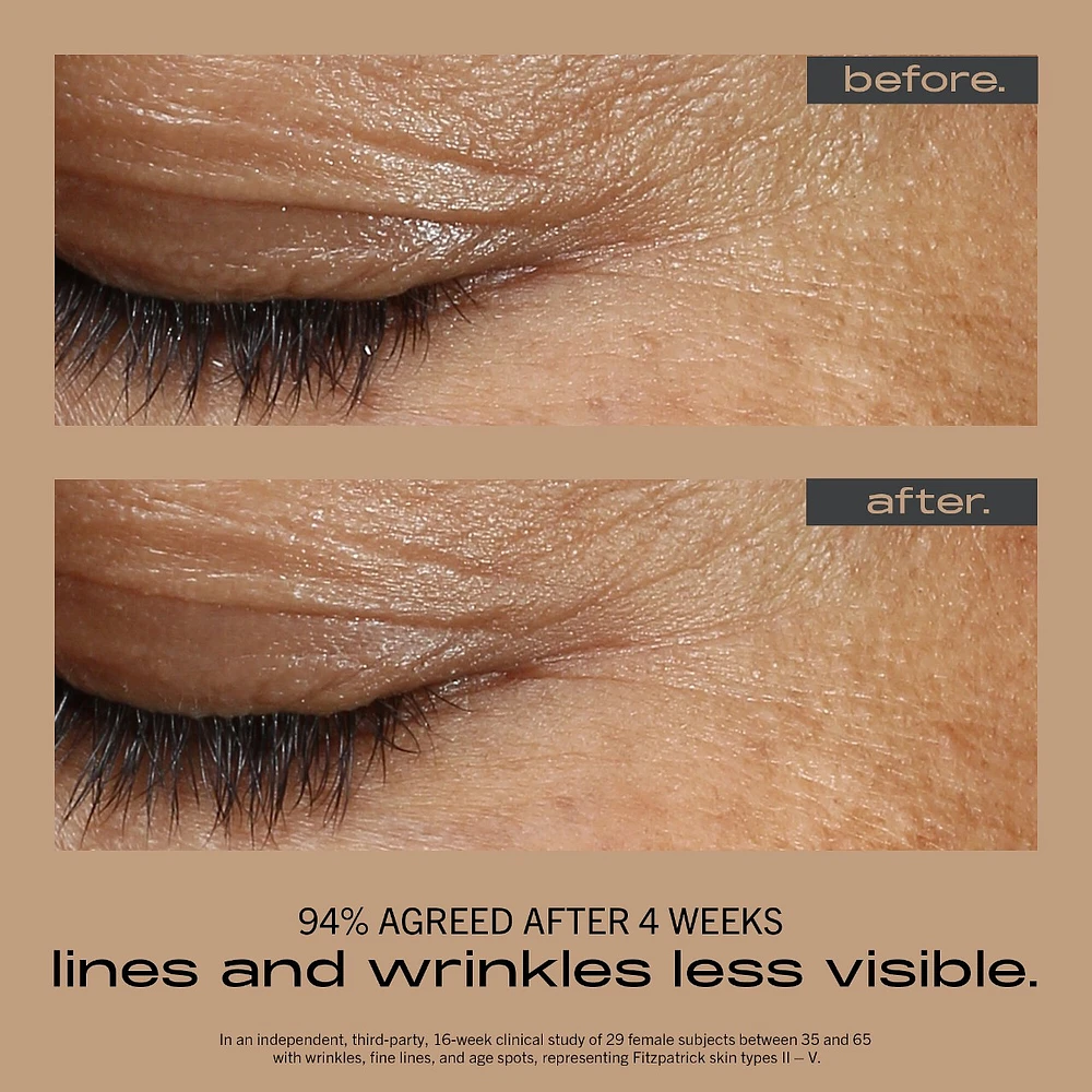 WRINKLE + TEXTURE CONCENTRATE with 0.2% Encapsulated Retinol, Vitamin C & Azelaic Acid