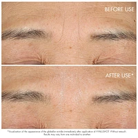 Capture Totale Hyalushot: Wrinkle Corrector with Hyaluronic Acid