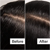 Cold Processed Scalp Detox Oil For Dry Scalp