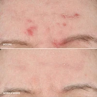 Vitamin Enriched Smoothing Serum with Niacinamide 