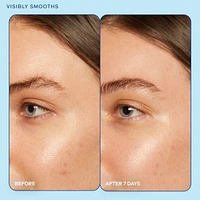 Skin Barrier Restoring + Pore Refining Gel Cream with Niacinamide