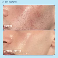 Skin Barrier Restoring + Pore Refining Gel Cream with Niacinamide