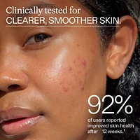 Clear Skin Physician-formulated Supplement for Acne and Breakouts