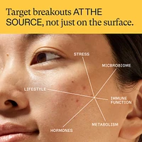 Clear Skin Physician-formulated Supplement for Acne and Breakouts