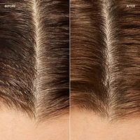 The Refillable Dry Shampoo