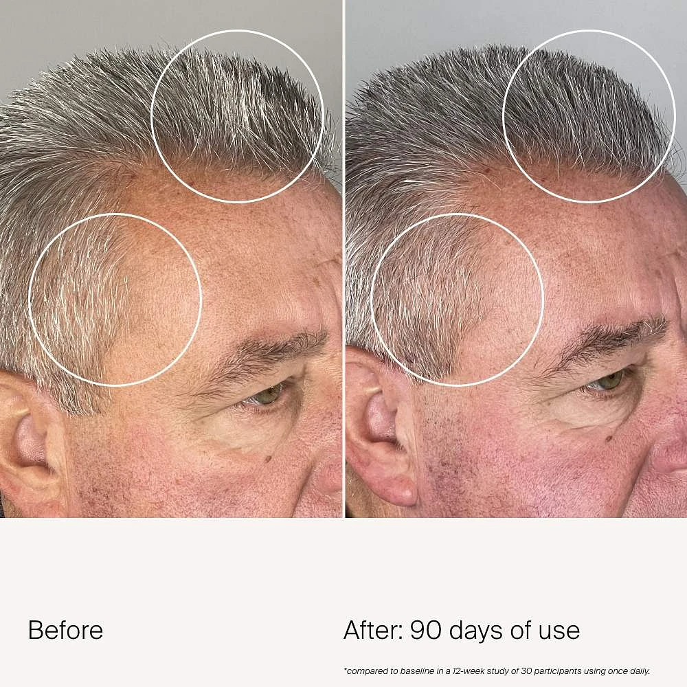 Scalp Care Density Serum for Thinning & Greying Hair