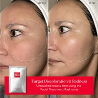 Brightening Facial Treatment Sheet Mask Twin Pack