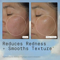 Deliverance Antioxidant & Niacinamide Serum For Calm & Even Skin