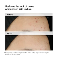Balancing & Clarifying Serum for Oily Skin and Pore Refinement