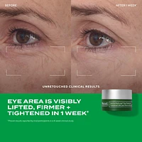 The Science of Healthy Skin: Lift and ReSculpt with Retinal