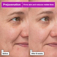 Prejuvenation Firming Bakuchiol Serum for Preventative Aging
