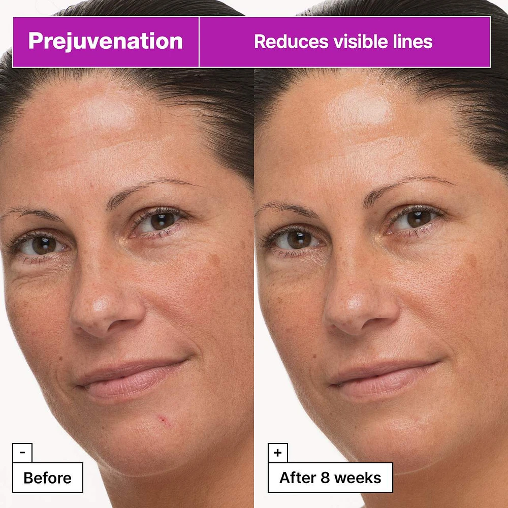 Prejuvenation Firming Bakuchiol Cream for Preventative Aging