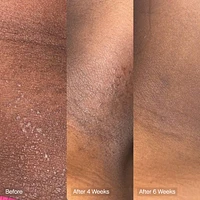 Faded Brightening & Cleansing Body Bar for Uneven Skin Tone (2 Pack)