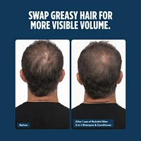Men's Active Cleanse Scalp Shampoo + Conditioner for Thinning Hair