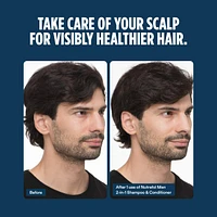 Men's Active Cleanse Scalp Shampoo + Conditioner for Thinning Hair