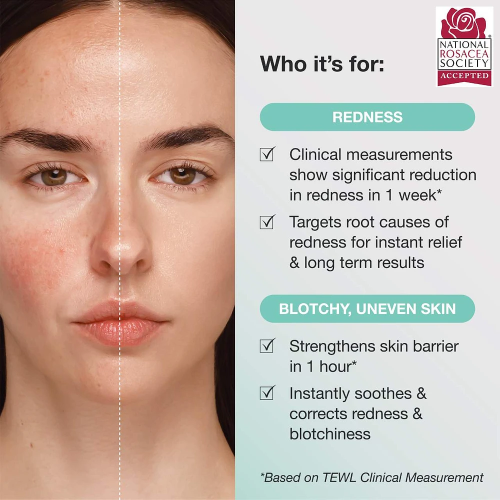 Calm the Red Down Dual Chamber Redness Treatment Serum