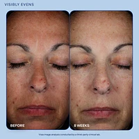 Exo + Ectoin Retinol-Alternative Intensive Skin Barrier Repair Baume