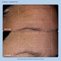 Exo + Ectoin Retinol-Alternative Intensive Skin Barrier Repair Baume