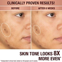 Dark Spot Correcting Radiance Recovery Serum
