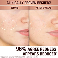 Dark Spot Correcting Radiance Recovery Serum