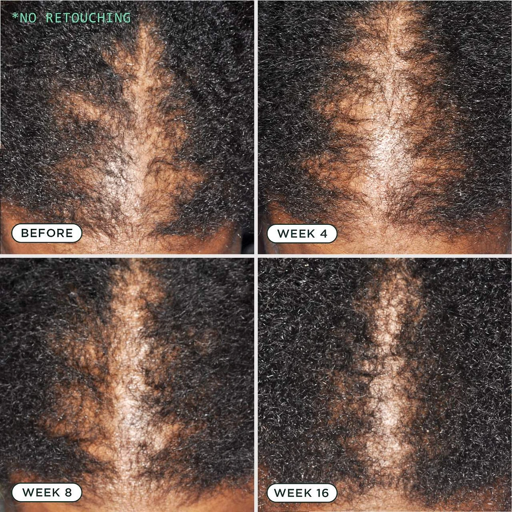 Density Nourishing Actives Scalp Serum for Hair Growth