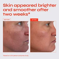 The Buzz Brightening Exfoliating Facial Treatment with AHA & BHA