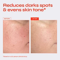 Brighten 5% Niacinamide Serum for Dark Spots & Uneven Texture