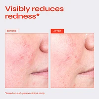 Destress Redness Calming Serum with Vitamin C & Ceramides