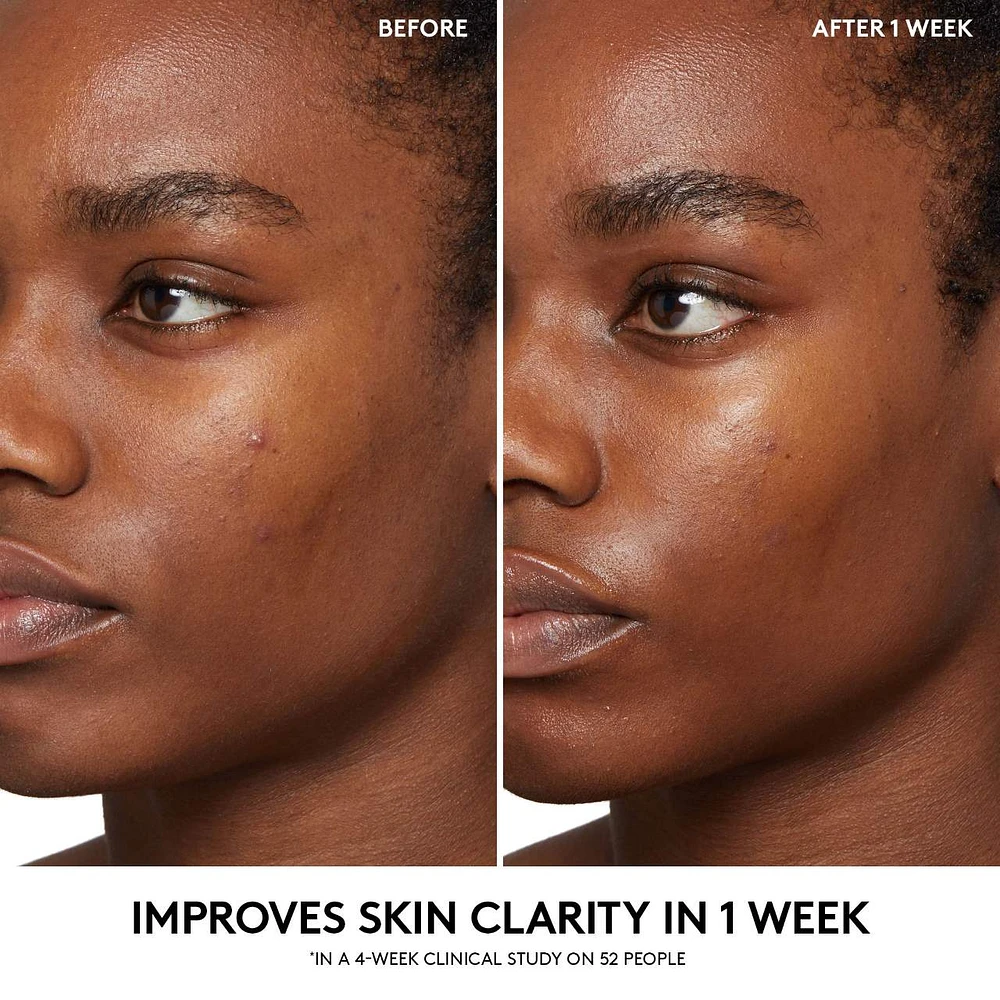 Cherry Dub BHA Toner with Salicylic Acid + Aloe Juice