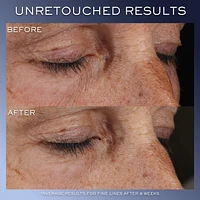 Genifique Ultimate Eye Cream for Dark Circles & Puffiness 