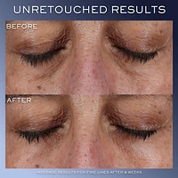 Genifique Ultimate Eye Cream for Dark Circles & Puffiness 