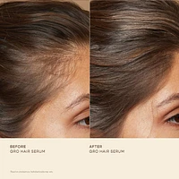 Healthy Hair Starter Set