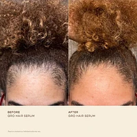 Healthy Hair Starter Set