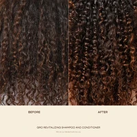 Healthy Hair Starter Set